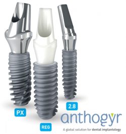 Dental implants Products London