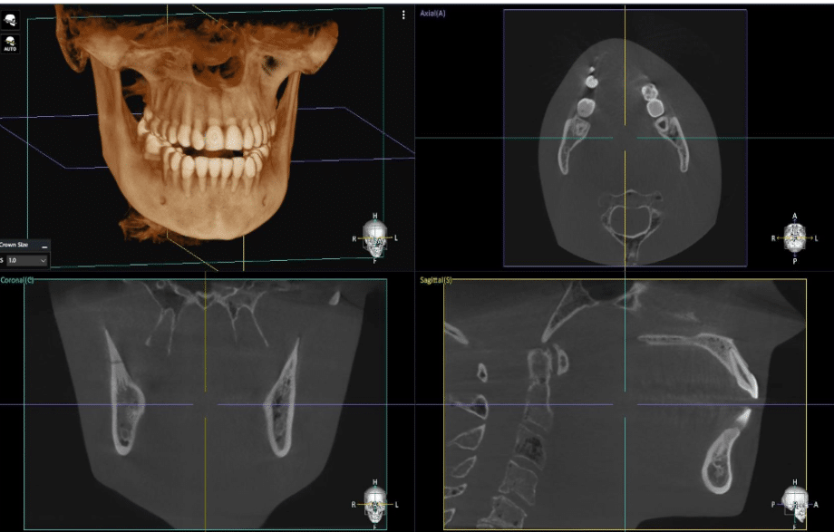 Dentium Rainbow CT 3 in 1 (CT+PANO+LINE CEPH) 2