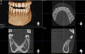 Dentium Rainbow CT 3 in 1 (CT+PANO+LINE CEPH) - Image 4