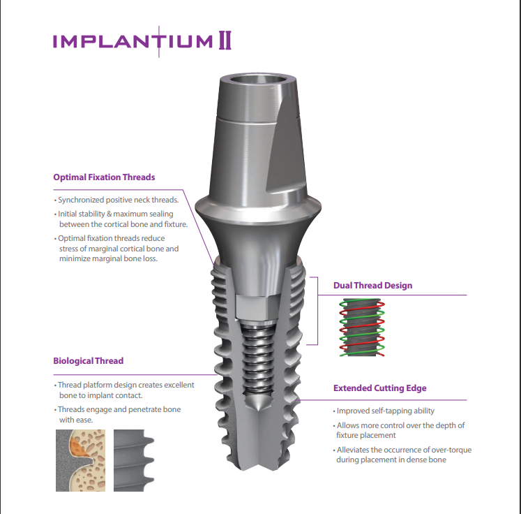 Best Implantium Dental Implants in the UK